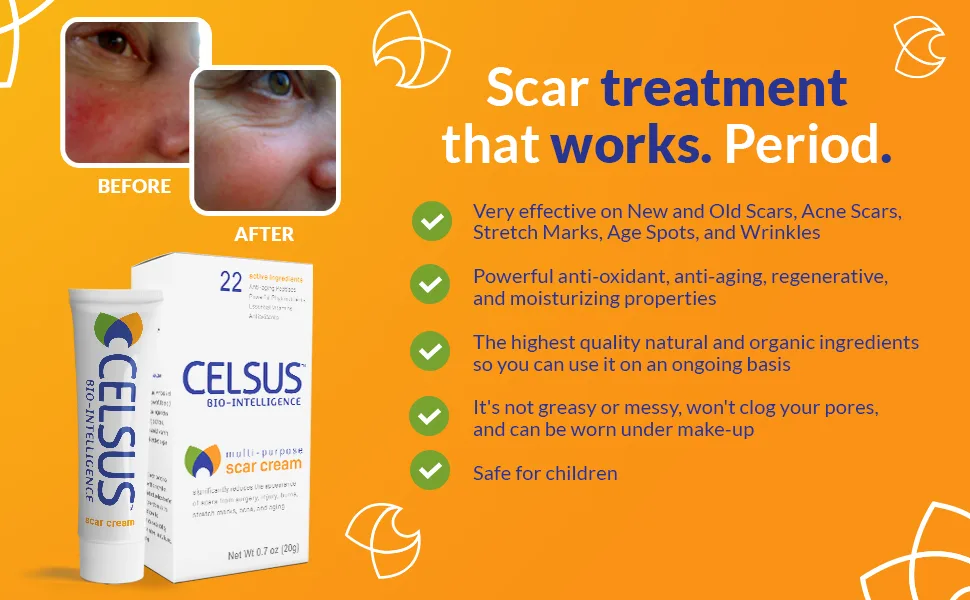 Celsus Bio-Intelligence Scar Cream 0.7 oz (20 g) - acne treatment, acne scars, get rid of acne scars, scar removal, scar treatment, scar cream, scars,