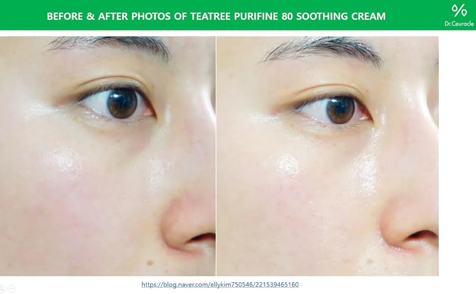 Dr. Ceuracle Tea Tree Purifine 80 Cream 1.76 oz (50 g) - teatree