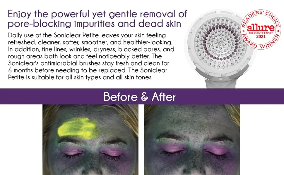 Michael Todd Beauty Soniclear Petite Antimicrobial Sonic Skin Cleansing System White Marble 5 Piece Kit - product information 3