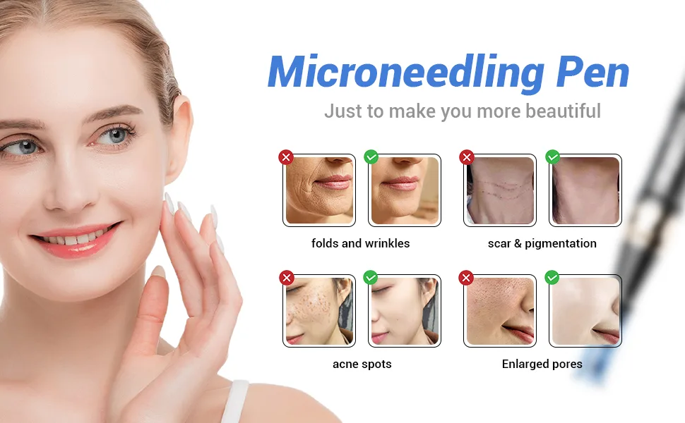 Dr.pen A8S Wireless Microneedling Pen Adjustable 0-0.25mm Micro Needling Pen LED Display Screen with 2 Replacement Cartridges(18pin) A8S-UK black - product information 19