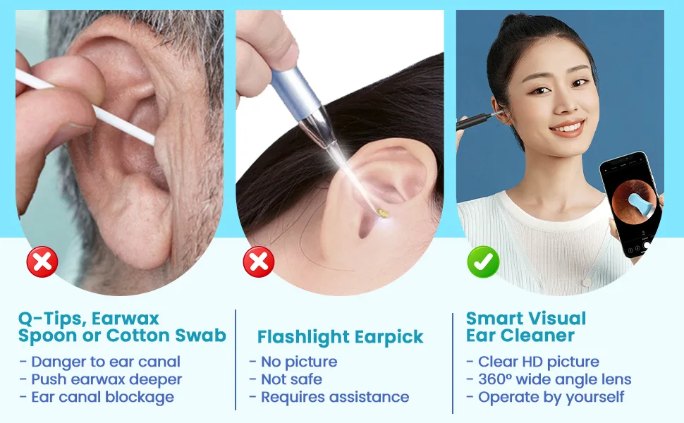 Smartbud Plus Ear Wax Removal Kit Professional 1080p (HD) Camera 6 LED Lights Wireless Ear Cleaner with Camera Wax Remover Otoscope for iPhone iPad & Android Smartphones - Earwax Removal Kit