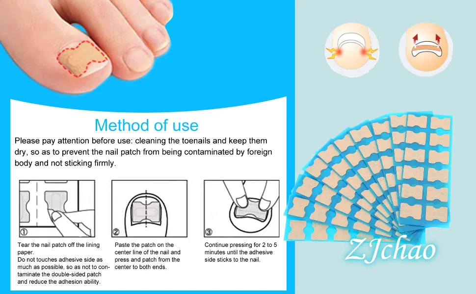 Ingrown Toenail Stick Patch Glue Free Toe Nail Correction File Patch Paronychia Corrector Foot Care Treatment Pedicure Tool Ingrown Toenail Correction Patch(3#) - treatment for ingrowing toenail