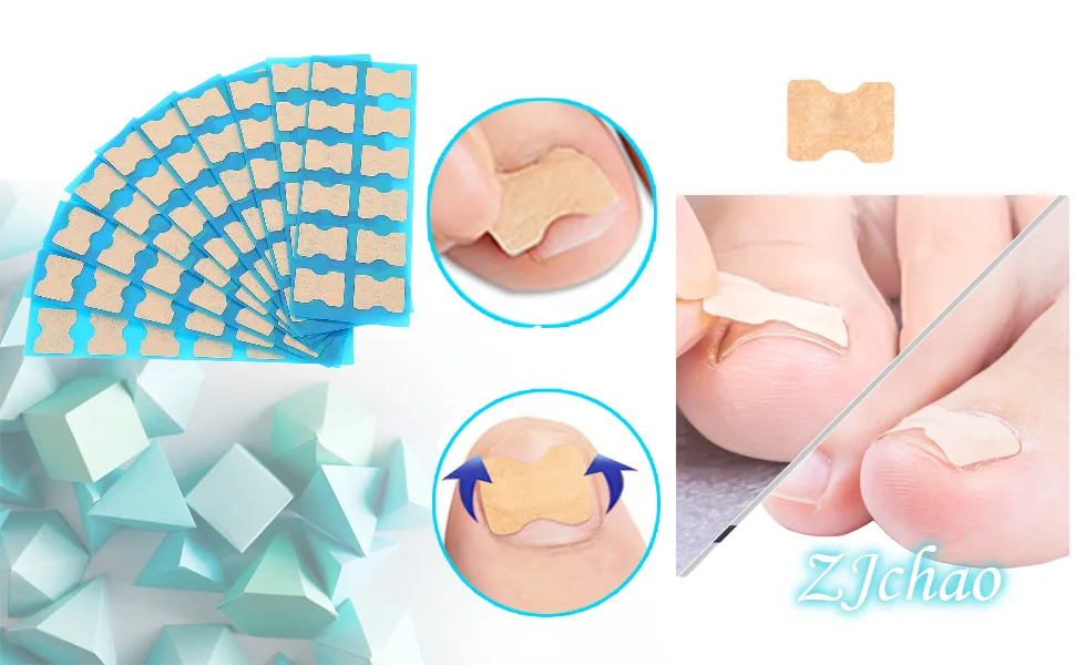 Ingrown Toenail Stick Patch 4 Sizes Glue-free Toe Nail Correction File Patch Paronychia Corrector Foot Care Treatment Pedicure Tool Ingrown Toenail Correction Patch(4#) - Ingrown Toenail Stick Patch