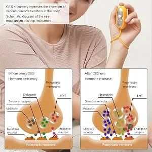 Sleep Aid Device Insomnia Instrument Sleep Instrument USB Charging Microcurrent Holding Sleep Instrument Anxiety Pressure Relief Sleep Aid Device Stress Relief(#1) - Sleep Aid Device
