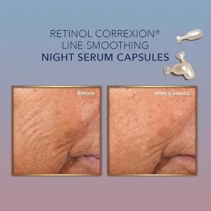 RoC Retinol Correxion Line Smoothing Night Serum Capsules 30 Biodegradable Capsules - Before and After
