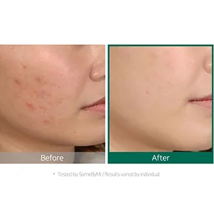 Some By Mi 30 Days Miracle Tea Tree Clear Spot Oil 10 ml - somebymi spot oil
