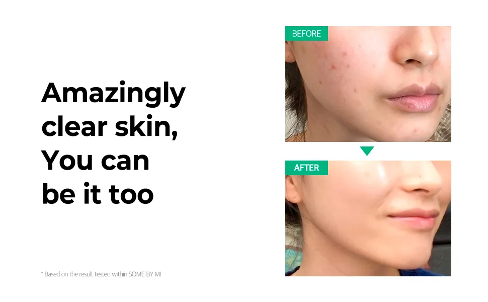 Some By Mi AHA. BHA. PHA 30 Days Miracle Cream 60 g - Miracle Cream Result