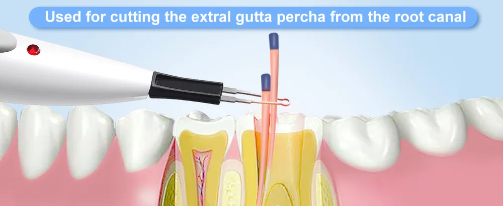Annhua Dental Tooth Gum Endo Obturation System with Heated Pen with 4 Tips - Gutta Percha Point Cutter