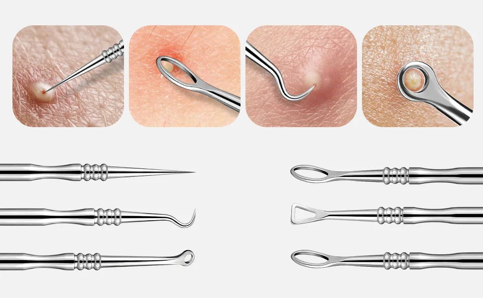 BEZOX Blackhead Remover Tools Pore Extractor Kit Set of 3 Stainless Pimple Popper Facial Tools with Metal Storage Case 3 pcs 1.0 - blackhead extractor blackhead remover kit blackhead remover tool kit blackhead tool spot popper tool