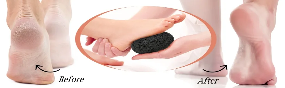 Maryton Pumice Foot Stone 2 Pcs - Pedicure Scrubber - Foot File and Callus Remover for Skin Exfoliation 2 Ct - 1111