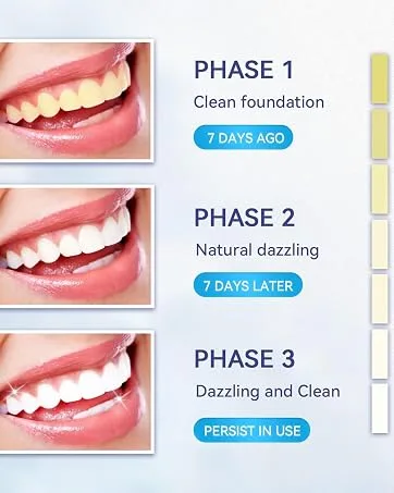 Teeth Whitening Strips Tooth Whitening Kits at Home Teeth whitening Strips Sensitive Teeth Whitening Strips Teeth Whitener 14 Packs 28 Pcs Shiny White - teeth whitening kit