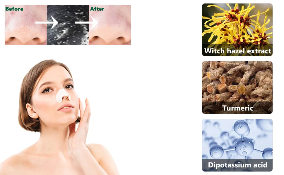 ALLY-MAGIC Nose Pore Strips 32 Pack Blackhead Remover Strips Deep Cleansing Nose Strips for Nose and Face Chin Forehead & Healthier Looking Skin Y4-QHTBT (Black) - product information 2
