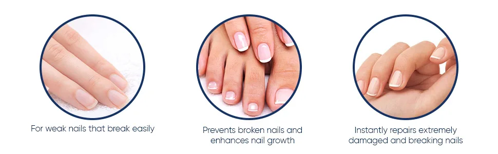 Herome Combi-Pack Exit Damaged Nails & Nail Hardener Extra Strong - Guarantees Strong Nails First Results In 8 Days - 7ml.+10ml. - E72527 EN - 2_970x300