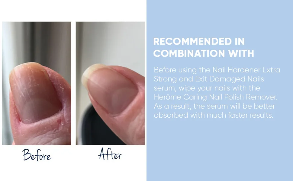 Herome Combi-Pack Exit Damaged Nails & Nail Hardener Extra Strong - Guarantees Strong Nails First Results In 8 Days - 7ml.+10ml. - E72527 EN - Bottom_970x600