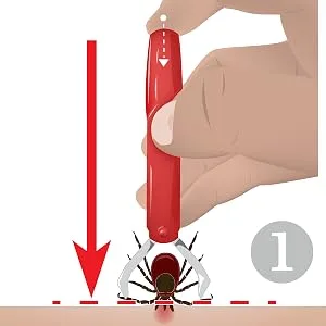 valonic tick remover 2 pack red tick removal tool tick remover for dogs and cats - valonic tick remover