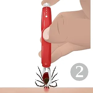 valonic tick remover 2 pack red tick removal tool tick remover for dogs and cats - valonic tick remover