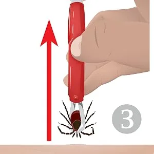 valonic tick remover 2 pack red tick removal tool tick remover for dogs and cats - valonic tick remover