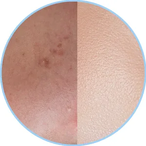 Fem diamond cr me bleaching 30 g - product information 5