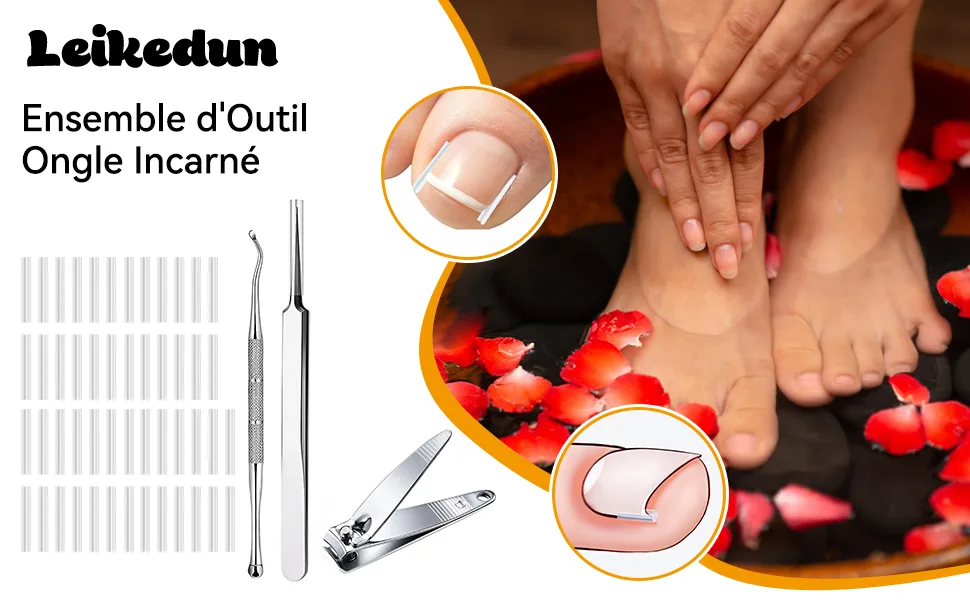 152 Pieces Ingrown Toenail Tool Set Toenail Correction Patch for Ingrown Toenails (Ingrown Toenails-7) - Eingewachsene Zehennägel