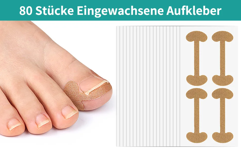 80 pieces toenail patch toenail correction patch ingrown toenails correction patch ingrown toenails pavement correction sticker toe nail for treatment protects toenails - Zehennagel Patch