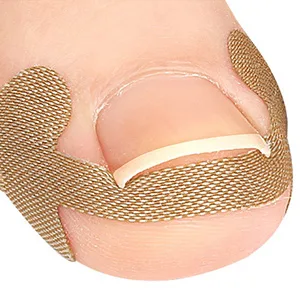 80 pieces toenail patch toenail correction patch ingrown toenails correction patch ingrown toenails pavement correction sticker toe nail for treatment protects toenails - Zehennagel Patch