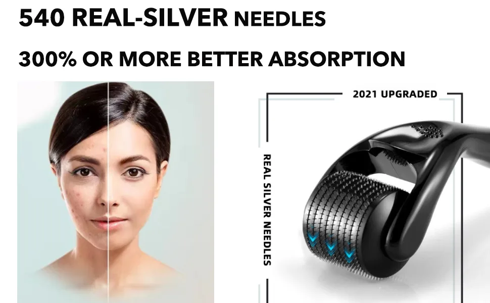 AUDUODUO Derma roller 0.3mm with REAL SILVER needles Micro needle Roller 540 for skin and hair care 0.3 mm - derma roller