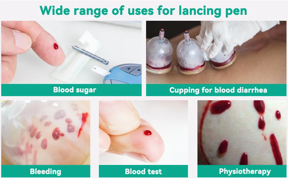Blood Lance Pen Stainless Steel Light Pain Cupping Acupuncture Massager Blood Testing Tools for Relaxing Trigger Self - product information 3