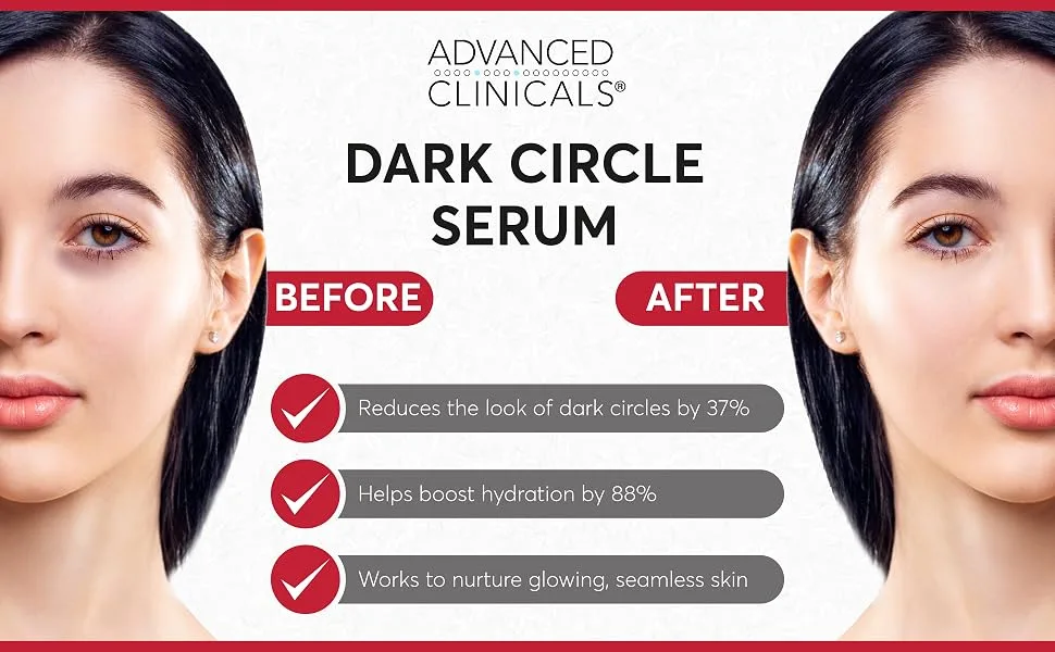 Advanced Clinicals Dark Circle Serum Fragrance Free 1.75 fl oz (52 ml) - dark circle serum