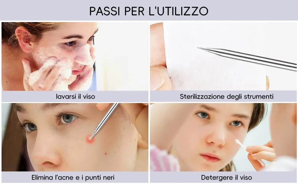 Blackhead removering pimples. - Reinigen Sie Ihr Gesicht