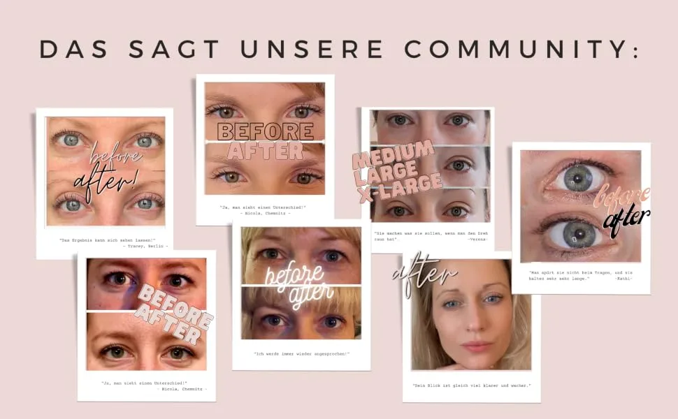 Bot 144 Slutoper Stripes for eyelid lift without surgery - Dermatest "very good" - Breathable mash technology - eyelid stripes invisible 144 x m - vorher-nachher Bilder