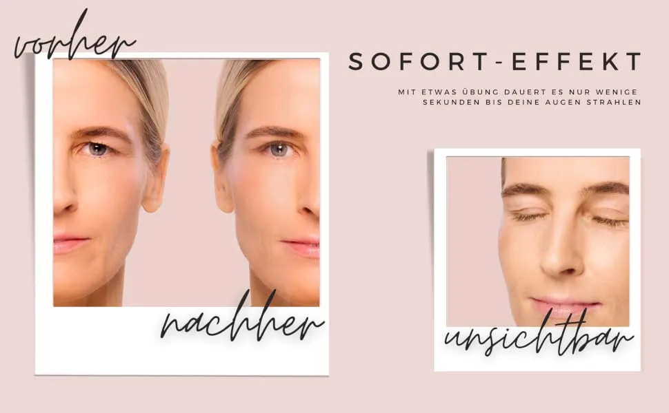 Bot 144 Slutopian stripes for eyelid lift without surgery - Dermatest "very good" - Breathable mash technology - eyelid stripes invisible 144 x L - sofort effekt