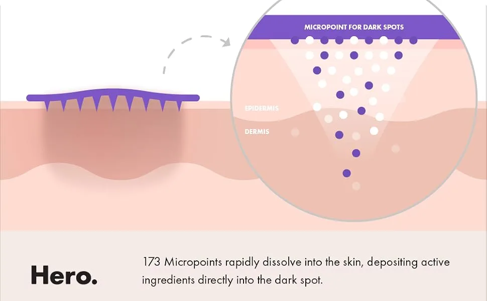 Hero Cosmetics Mighty Patch Micropoint for Dark Spots 6 Patches - how micropoint works