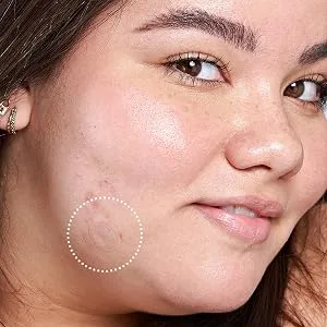 Hero Cosmetics Mighty Patch Micropoint for Dark Spots 6 Patches - ultra-thin and barely visible