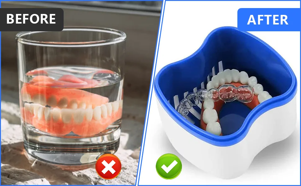 Xtudou prosthetic box set (2 dentist dental dinner 2 dental prostheses container 2 prosthesis cleaning brushes with double heads) for false teeth and braces storage cleaning - Prothesendose Set
