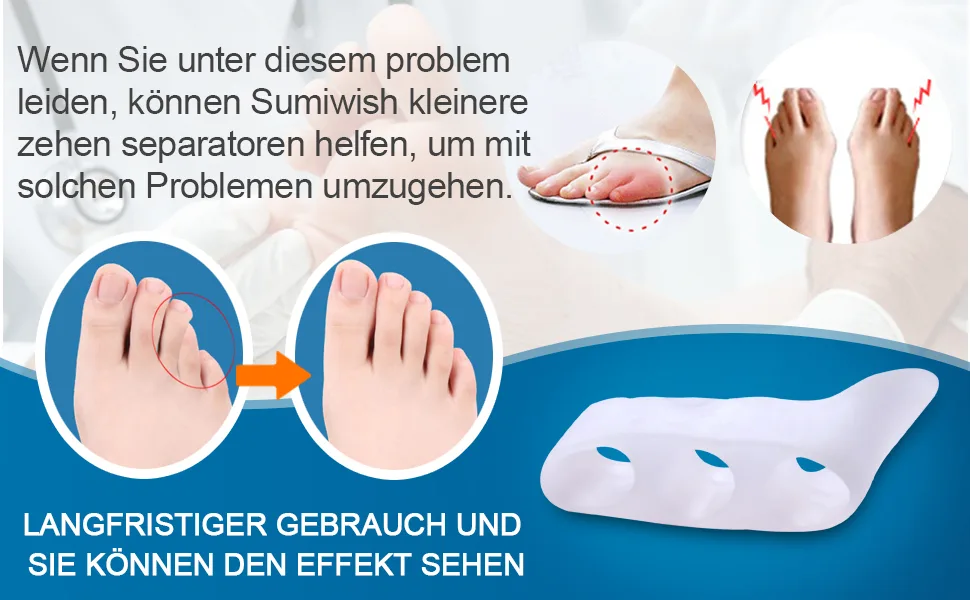 Sumiwish 10x Toe spreader silicone small toe separator & protector for overlapping toes relief small toes pressure and pain clear - product information 3