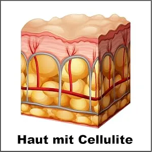 CREMAFIT TONED Fights fat deposits and deep and stubborn cellulite for legs and buttocks. 150ml - Haut mit Cellulite