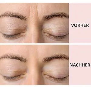 Sandy Skin 3x anti -fold pads - remove decoltea folding decorative padsReusable eye pads anti -fold breast |Anti forehead wrinkles pad |Anti -aging - product information 8