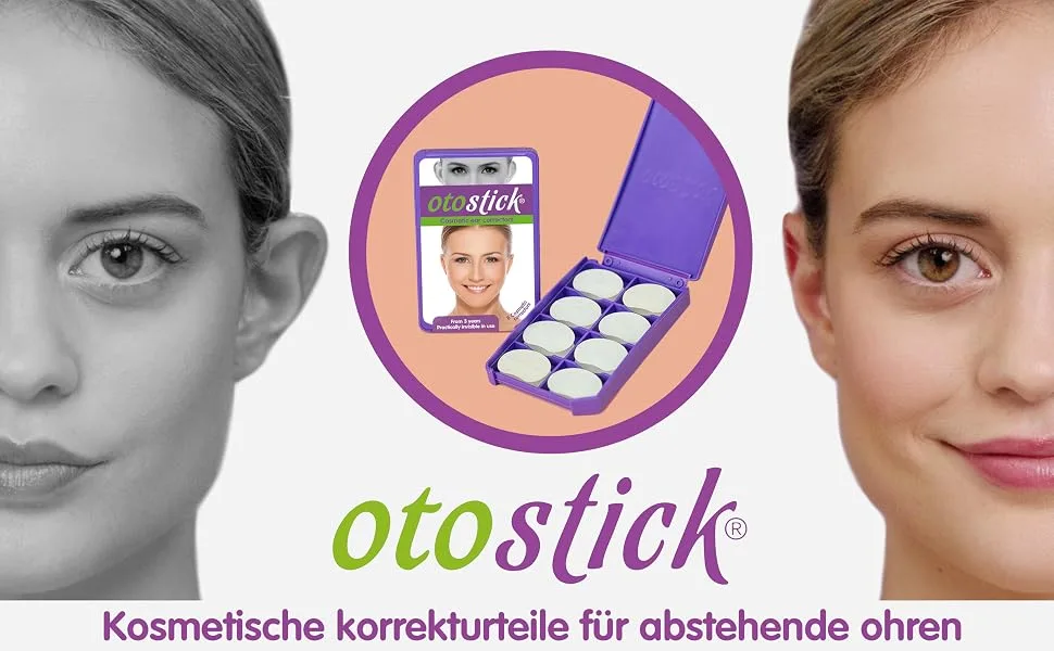 Otostick Aesthetic Ear Correction (3 pieces) - otostick