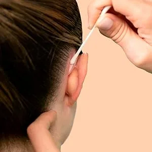 Otostick Aesthetic Ear Correction (3 pieces) - otostick