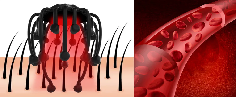 Head massage spider electrically with red light portable Bluetooth head massager with 20 vibration contacts and 5 modes for head relaxation and deep sleep ideal gift ideas - product information 2