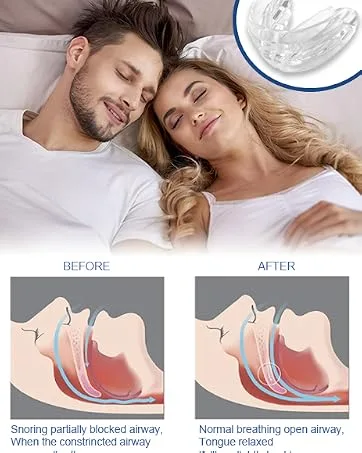Anti-snoring rail tooth rail crunch effectively bite track against teeth grinding bite track for Mouth Guard snoring stopper for night improvements sleep quality - product information 6