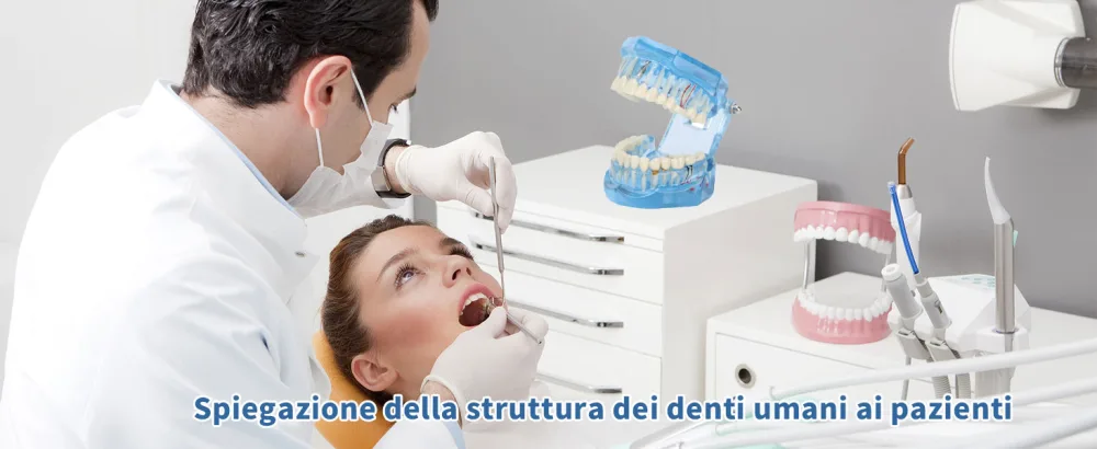 Tooth model standard model adult pathologies dental implant dentist blue-transparent acrylic tooth model for pedagogical demonstration tooth model removable simulation - Modello Standard Dentale Denti