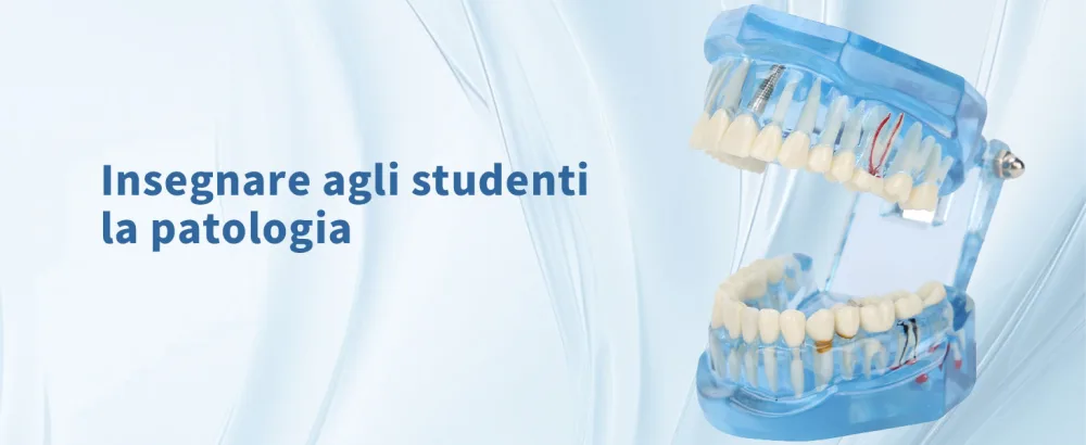 Tooth model standard model adult pathologies dental implant dentist blue-transparent acrylic tooth model for pedagogical demonstration tooth model removable simulation - Modello Standard Dentale Denti