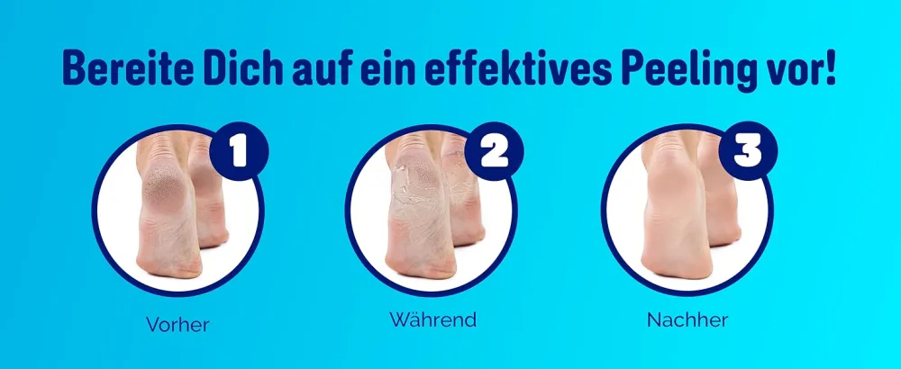 Scholl Callus Remover Mask - Callus Socks - Mask for silky soft feet - product information 18