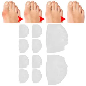 Fybida Bunion Corrector Toe Separator Bunion Corrector 5 Holes Hallux Valgus Corrector High Elasticity SEBS Foot Toe Straightener (White) - Bunion Korrektur
