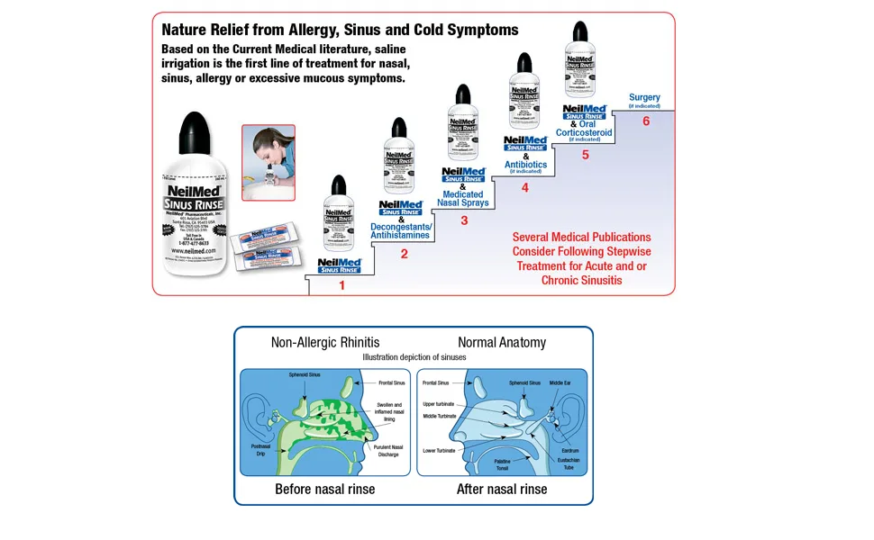 NeilMed Sinus Rinse - A Complete Sinus Nasal Rinse Kit 50 count (Pack of 1) - NeilMed Sinus Rinse