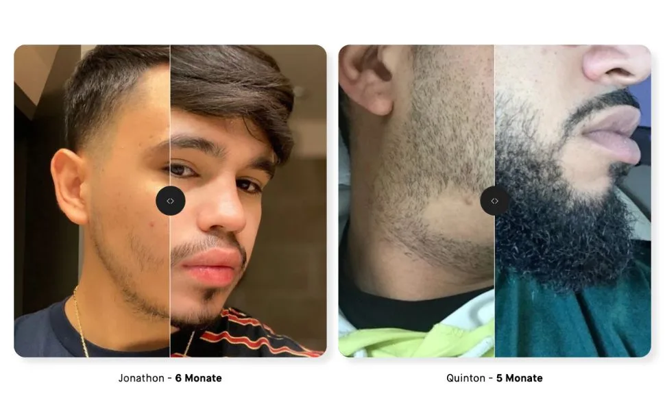 Copenhagen Grooming Set for Bart growth-the original beard growth set for a fuller stronger beard.With a proven growth activator serum dermar roller-250 days 8-part set - product information 10