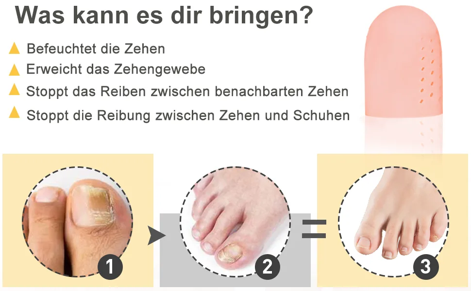 Welnove 10x toe caps toe protection large toe toe protection breathable -active toe sleeves for chicken eyes bubbles missing or ingrown toenails (beige) 10 large (peach) - product information 10