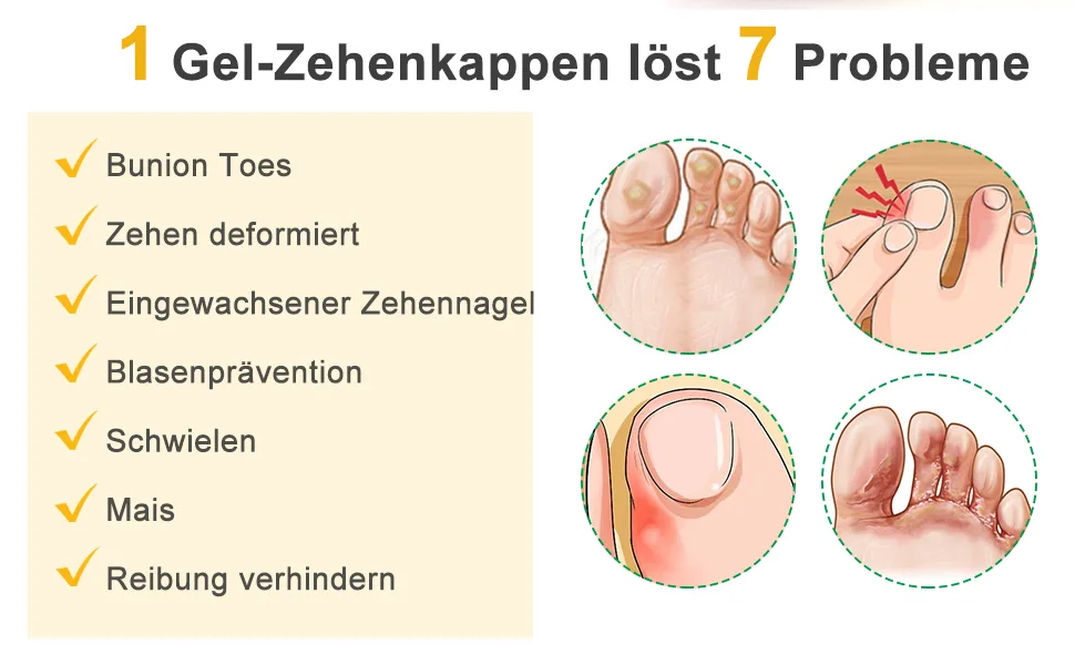 Welnove 10x toe caps toe protection large toe toe protection breathable -active toe sleeves for chicken eyes bubbles missing or ingrown toenails (beige) 10 large (peach) - product information 9
