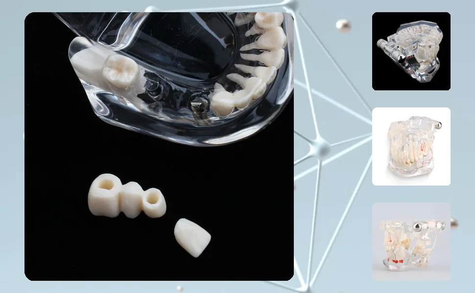 Cocoarm dental care model removable tooth model doctor dental demo implant dentist teaching study model transparent teaching tool for dentist demonstration - product information 21